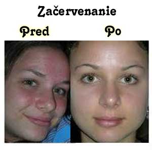 Galvanic Spa